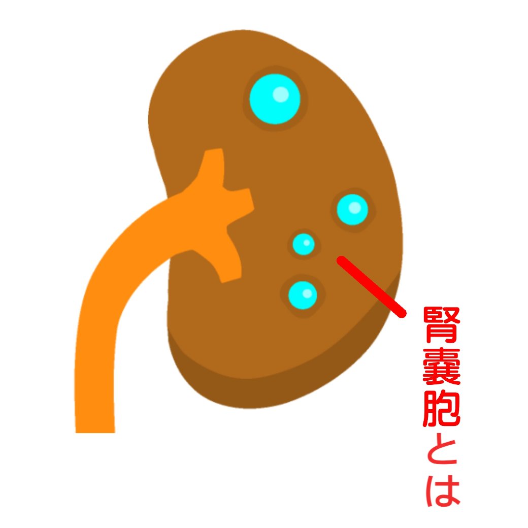 腎のう胞とは